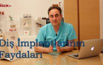 Diş İmplantlarının Faydaları- Prof Dr Bülent Kurtiş - Sağlık