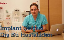 İmplant Çevresi Diş Eti Hastalıkları - Prof Dr Bülent Kurtiş - Sağlık