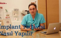 İmplant Tedavisi Nasıl Yapılır - Prof Dr Bülent Kurtiş - Sağlık