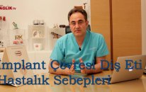 İmplantlar çevresi diş eti hastalıklarının sebepleri nedir - Prof Dr Bülent Kurtiş - Sağlık