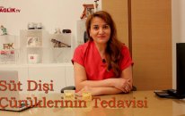 Süt Dişi Çürüklerinin Tedavisi – Burcu Kurtiş - Sağlık