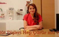 Süt Dişleri Hep Çürür Mü – Burcu Kurtiş - Sağlık