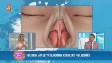 Burun Ucu Estetiği Kimler İçin Uygundur, Burun Ucu Estetiği Riskleri, Burun Ucu Estetiği Sonrası ...