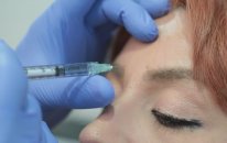 KBB Uzmanı Doç. Dr. Teoman Dal - Botox ve Dolgu