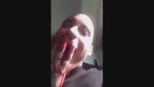 Kendini Yanağından Vuran Amaçsız Adam