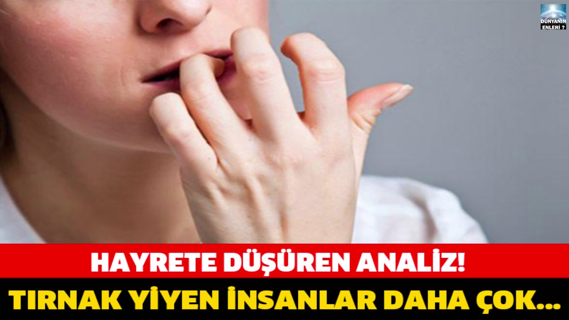 Etiket: tırnak yeme alışkanlığı Etiket: tırnak yeme alışkanlığı