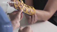 Tıbbi Alçılarda 3D dönemi