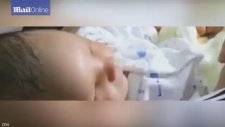Çinli Bebek Gözleri Olmadan Doğdu