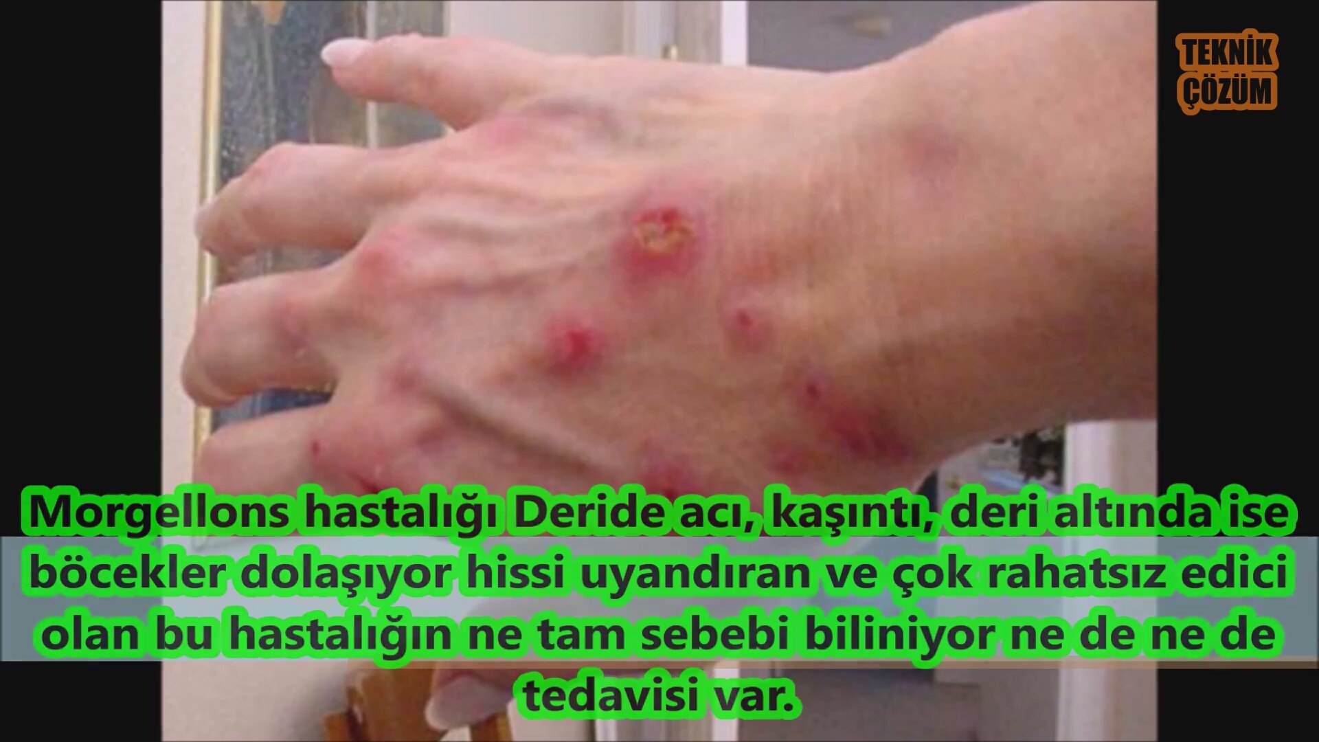 Üç Boyutlu Çilek Lif Modeli Yapılışı Videolu Anlatımlı Üç Boyutlu Çilek Lif Modeli Yapılışı Videolu Anlatımlı