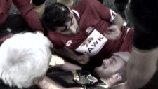 Kolu Kırılan Futbolcuyu Teskin Etme Yöntemi