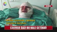 Çakmak Gazı Çekerken Otomobili Patlatmak