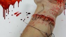 I reattached my hand!