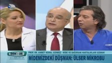 Mide Ülserinin Tedavisi Nedir?