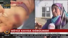 Komşusunun Parmağını Isırıp Yuttu
