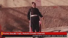 SGK, 74 Yaşındaki Protez Bacaklı Vatandaşa Çalışabilir Raporu Verdi