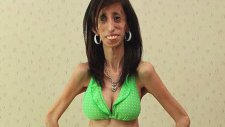 Dünyanın En Çirkin Kadını: Lizzie Velasquez