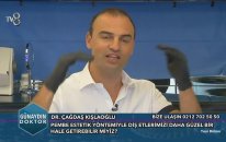 Diş Beyazlatma ve Pembe Estetik nasıl uygulanır?
