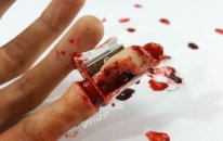 Kalem Tıraşla Parmağımı Açtım!!