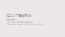 Amara Medical Aesthetics Offers Enlighten Laser Tattoo Removal İn Bellevue