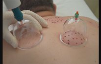 Alanya Hacamat / Hajamat 90 505 016 4749