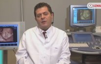 Doğum Kontrol İlaçları Kilo Aldırır Mı? - Dr. Kağan Kocatepe