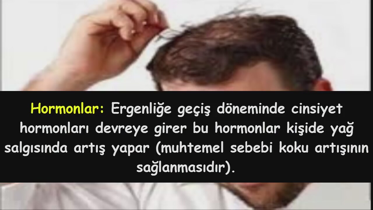 Saçtaki Sarımsak Kokusu Nasıl Çıkar Saçtaki Sarımsak Kokusu Nasıl Çıkar