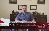 Karın Germek İçin Liposuction Gerekli Mi & Dr Ali Mezdeği