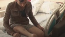 Bacağı 180 Derece Ters Dikilen Adam