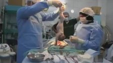 Ölü Doğmuş Bebeği Kurtarmaya Çalışan Doktorların Gözleri Yaşartan Mücadelesi
