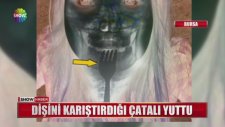 Dişini Karıştırırken Çatalı Yutmak