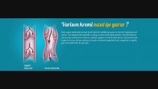 Orjinal Varison Varis Kremi