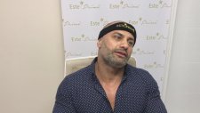 Hairtransplant Turkey Reviews -Saç Ekimi Tavsiye Ediyorum