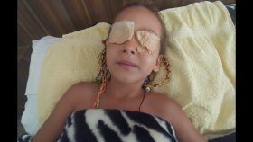 Elifin Gözleri Hastalandı, Nasıl Tedavi Uyguladık, Bu Havuzda Yüzemedik Bir Türlü ...