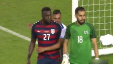 Jozy Altidore'a Isırık Şoku!