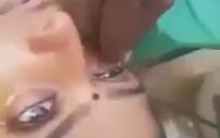 Hindistan'da Göz Tedavisi